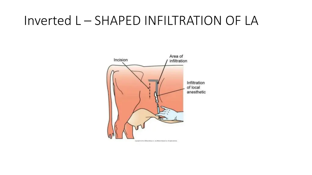 inverted l shaped infiltration of la