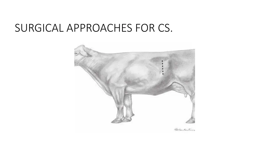 surgical approaches for cs