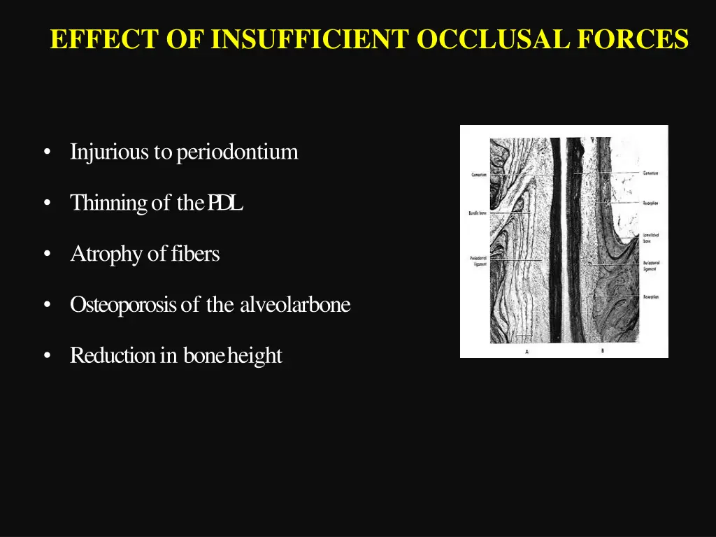 effect of insufficient occlusal forces