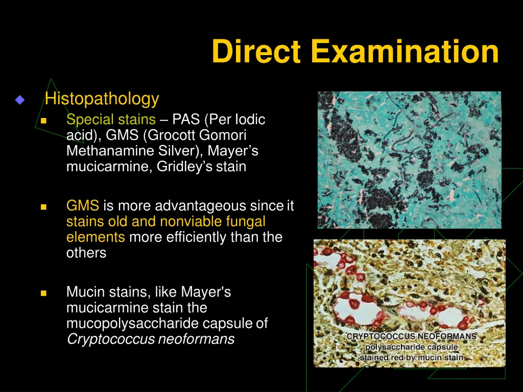 direct examination 2