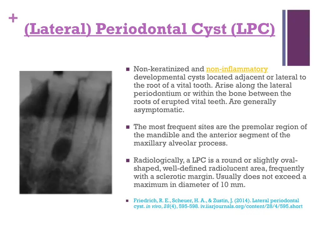 lateral periodontal cyst lpc