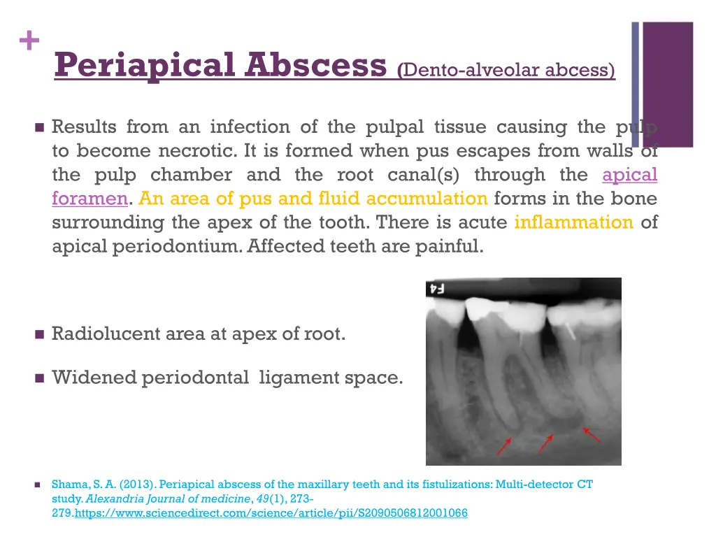 periapical abscess dento alveolar abcess