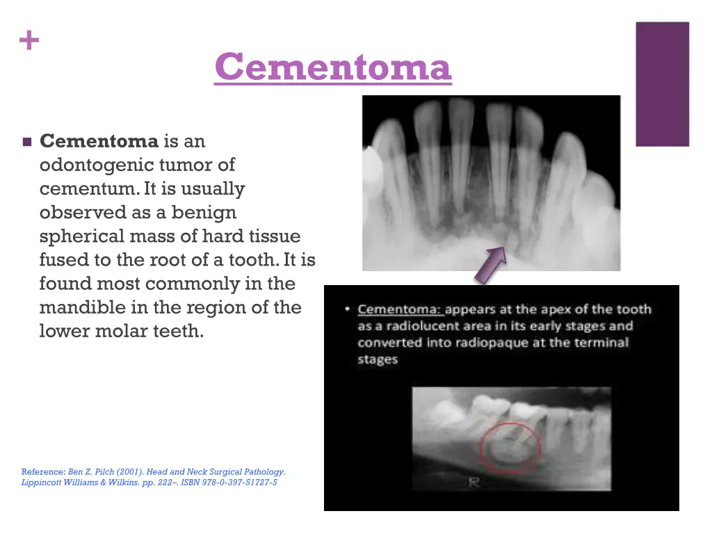 slide11