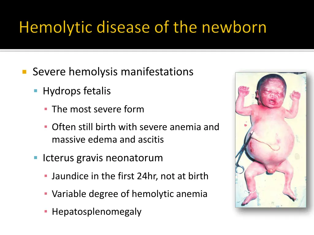 severe hemolysis manifestations