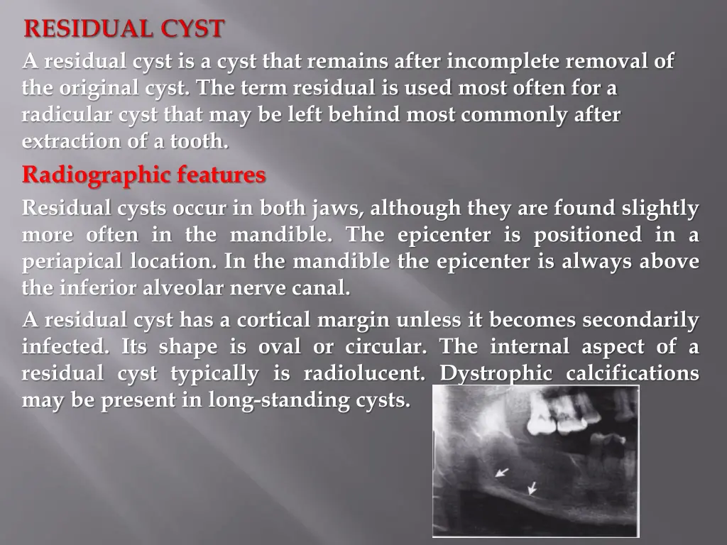 a residual cyst is a cyst that remains after