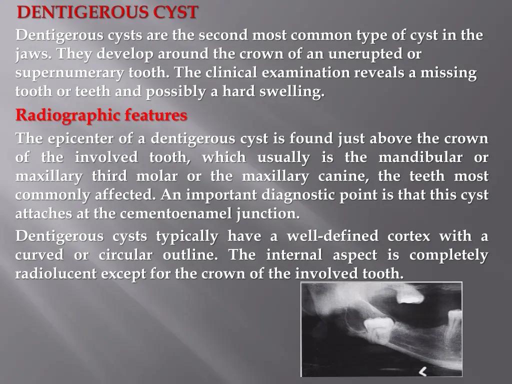 dentigerous cysts are the second most common type