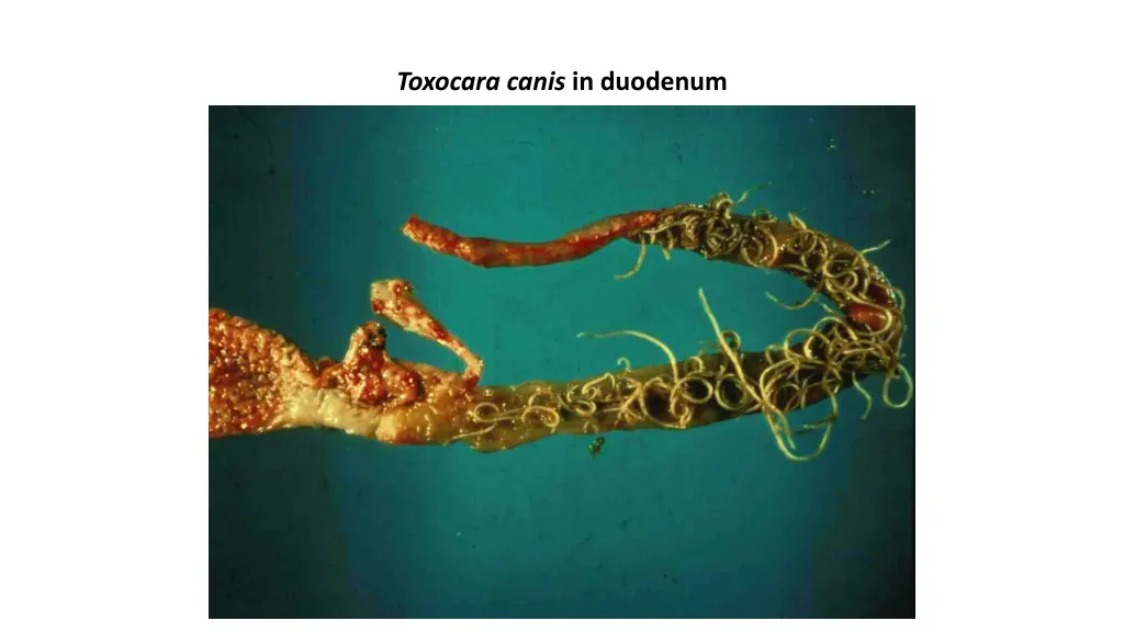 toxocara canis in duodenum