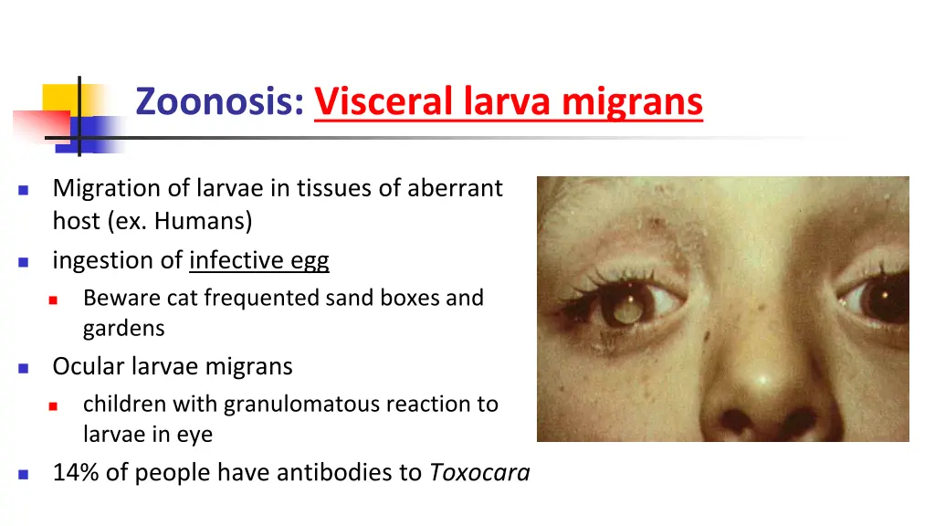 zoonosis visceral larva migrans