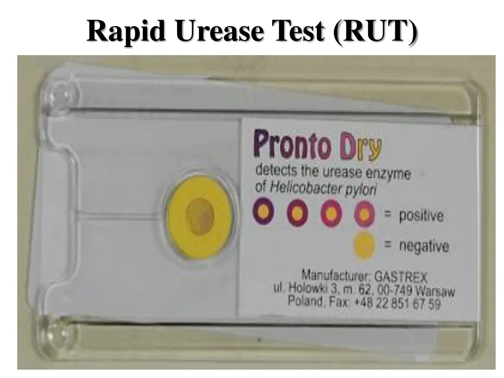 rapid urease test rut 1