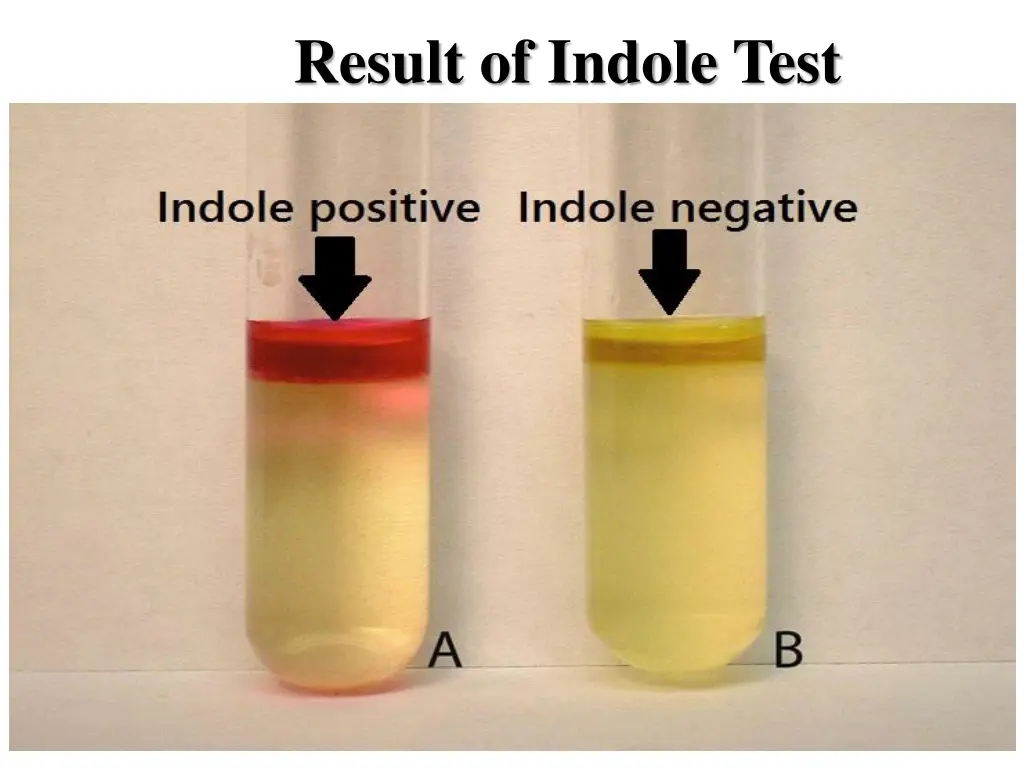 result of indole test