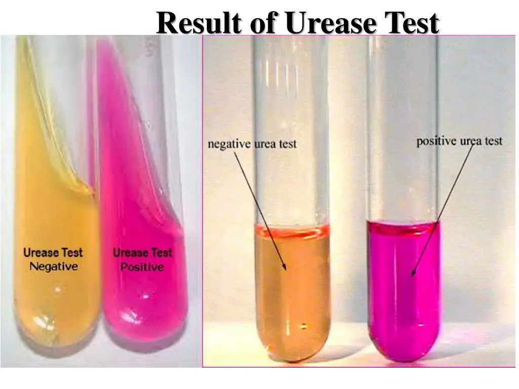 result of urease test