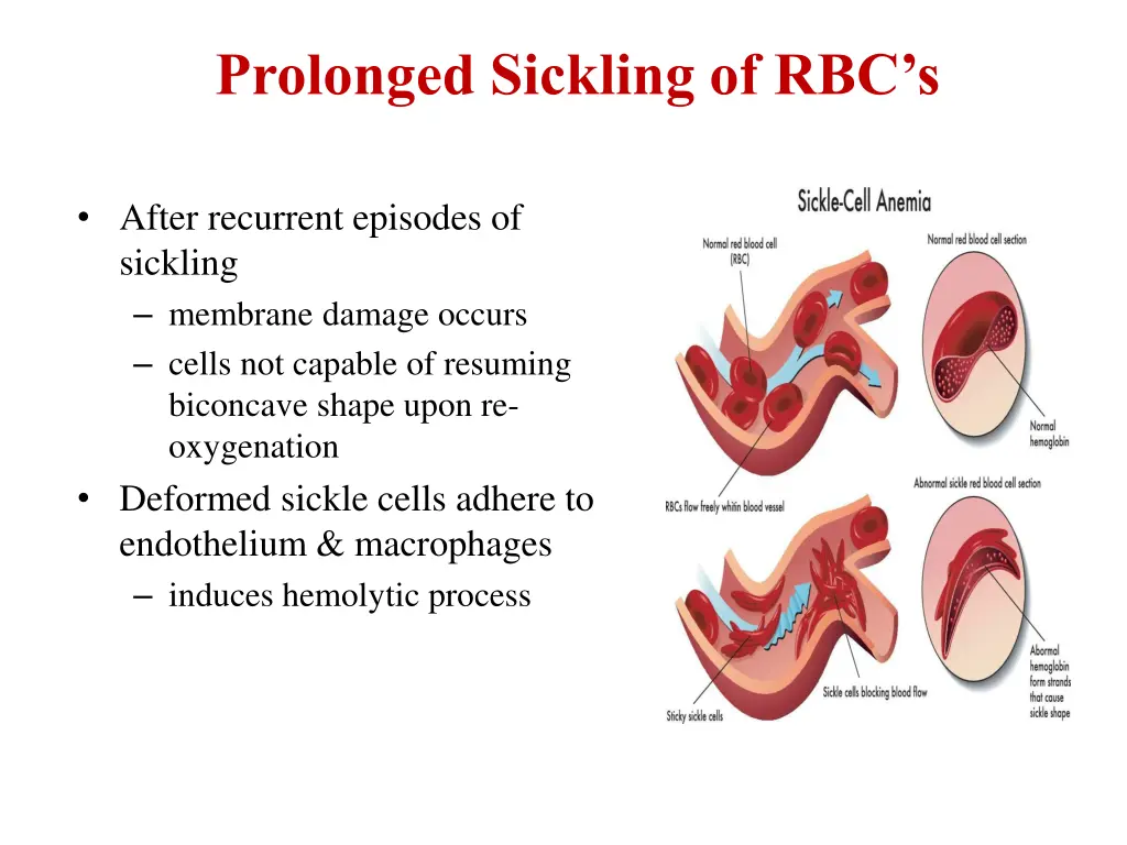 prolonged sickling of rbc s