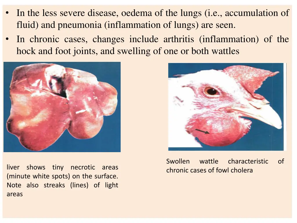 in the less severe disease oedema of the lungs