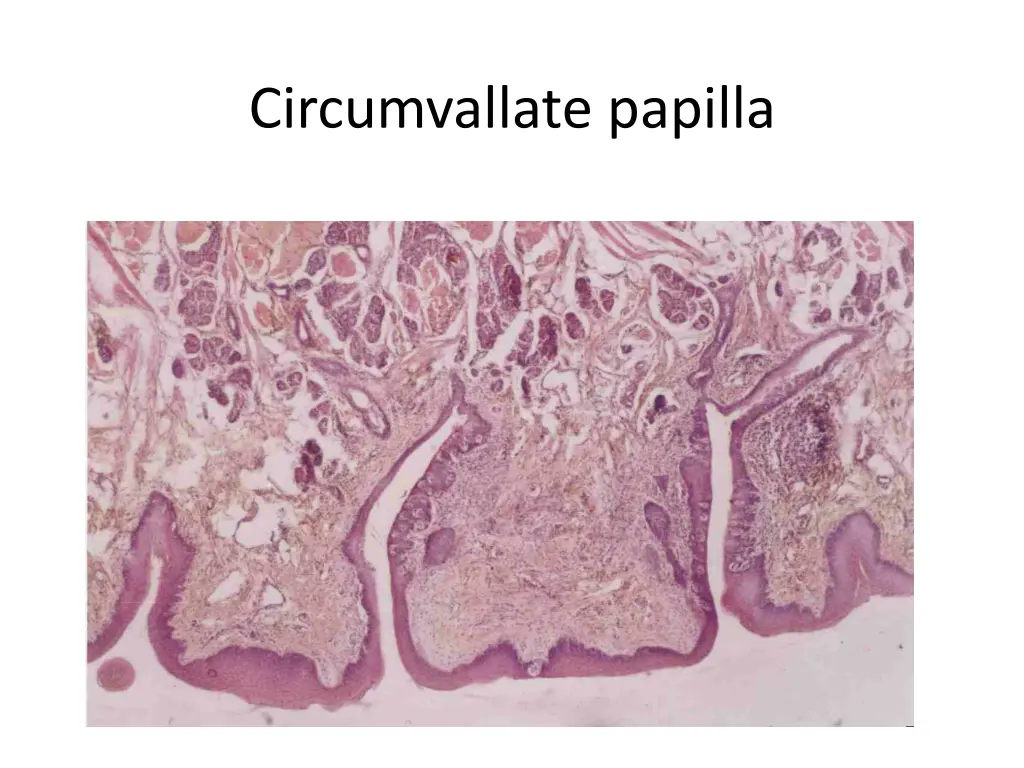 circumvallate papilla