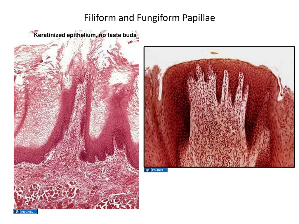 filiform and fungiform papillae