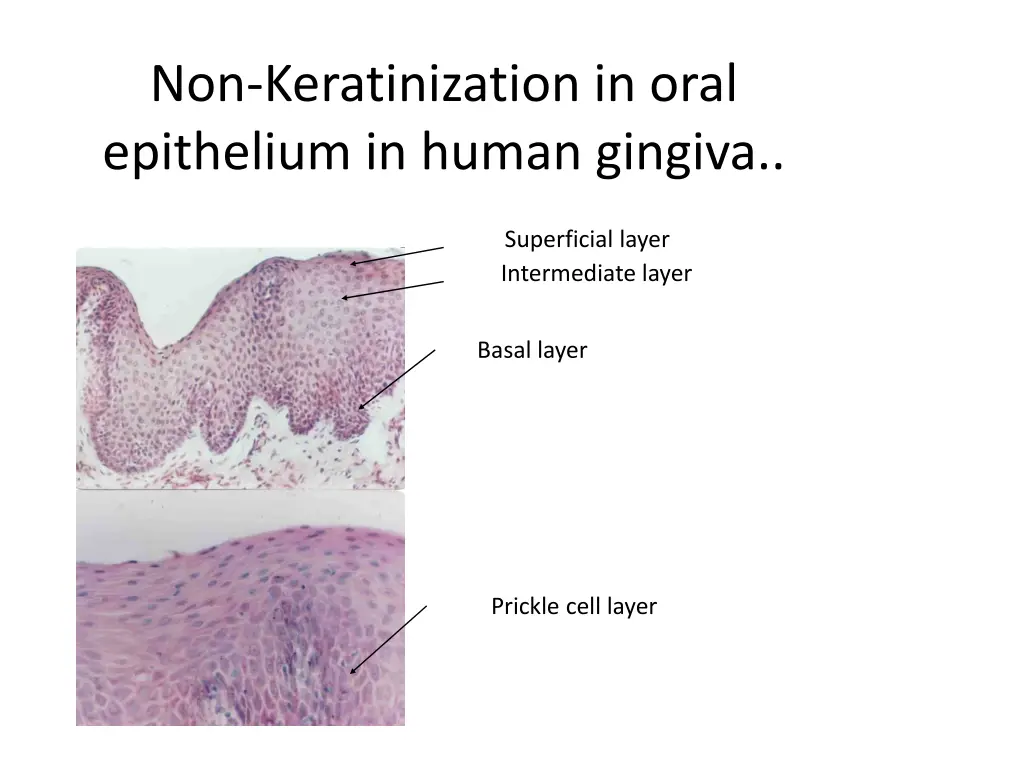 non keratinization in oral epithelium in human