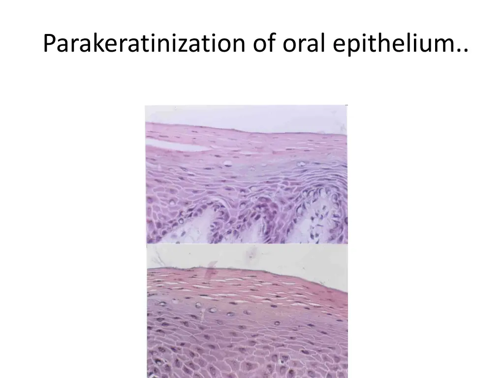 parakeratinization of oral epithelium