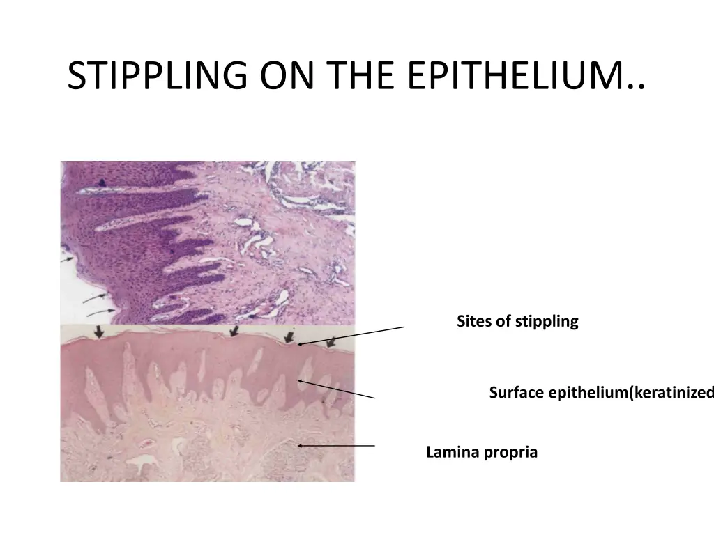 stippling on the epithelium