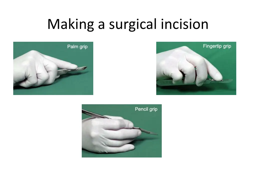 making a surgical incision