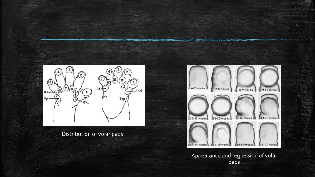 distribution of volar pads