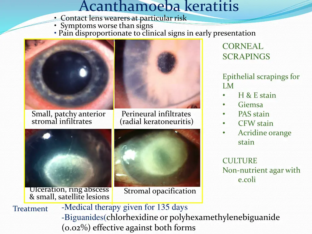 acanthamoeba keratitis contact lens wearers