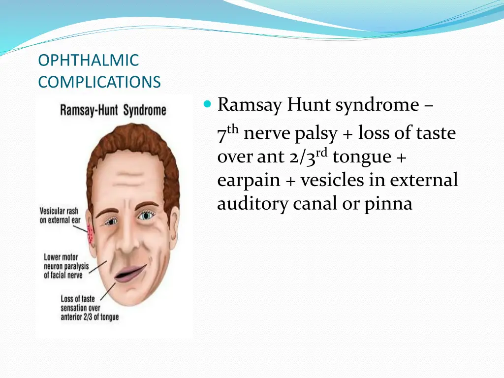 ophthalmic complications