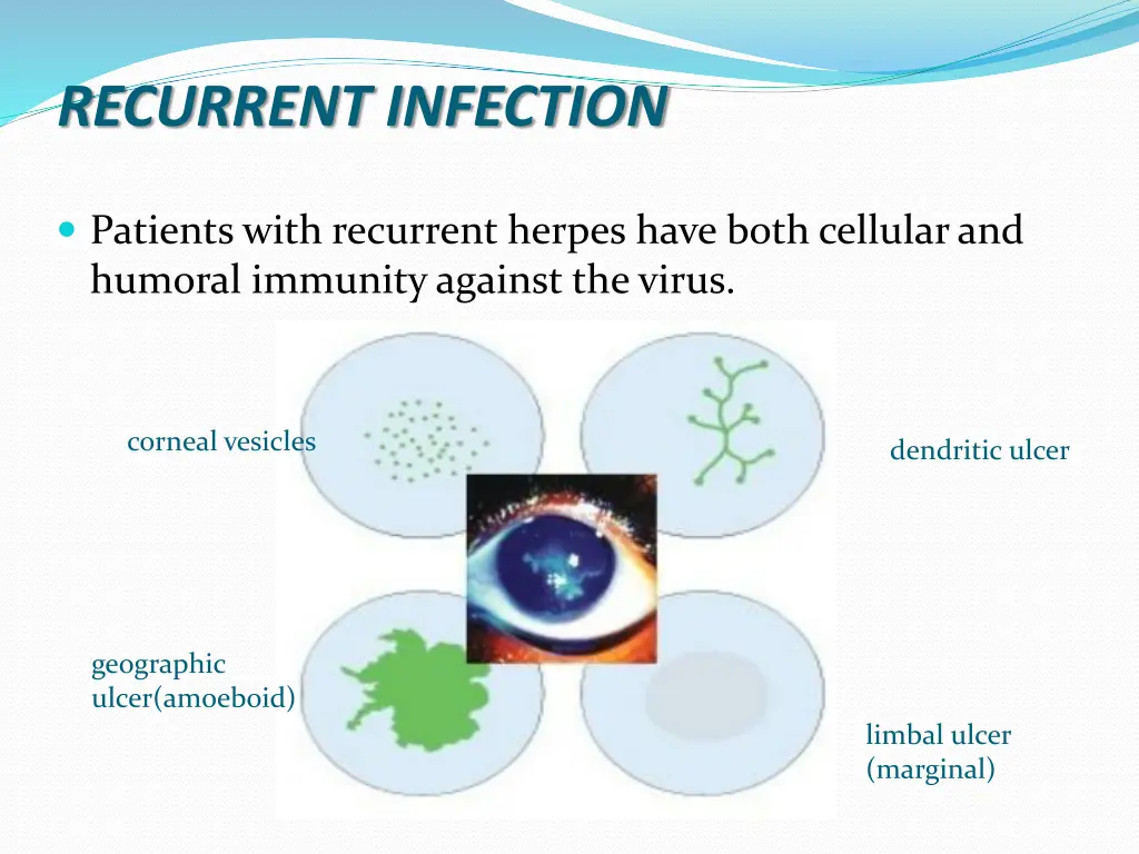 recurrent infection