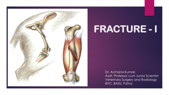 fracture fracture i i