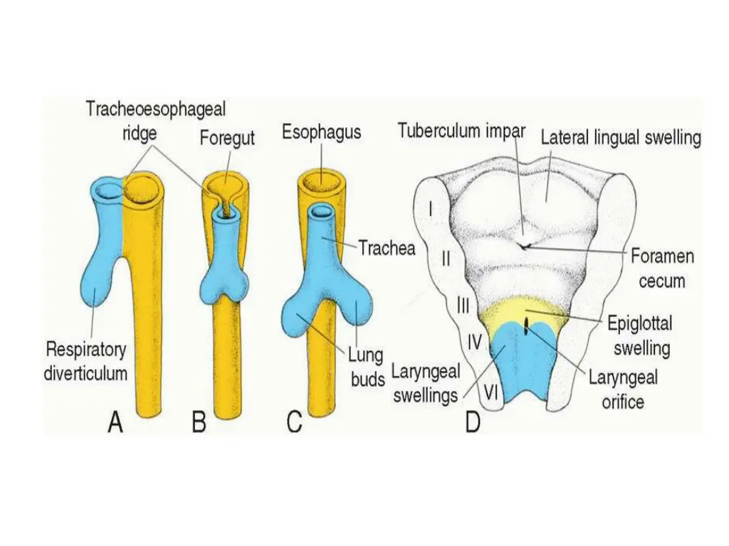 slide3