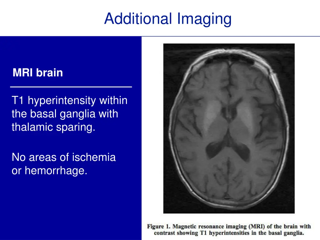 additional imaging