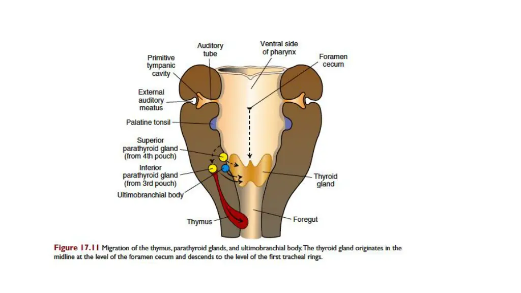 slide6