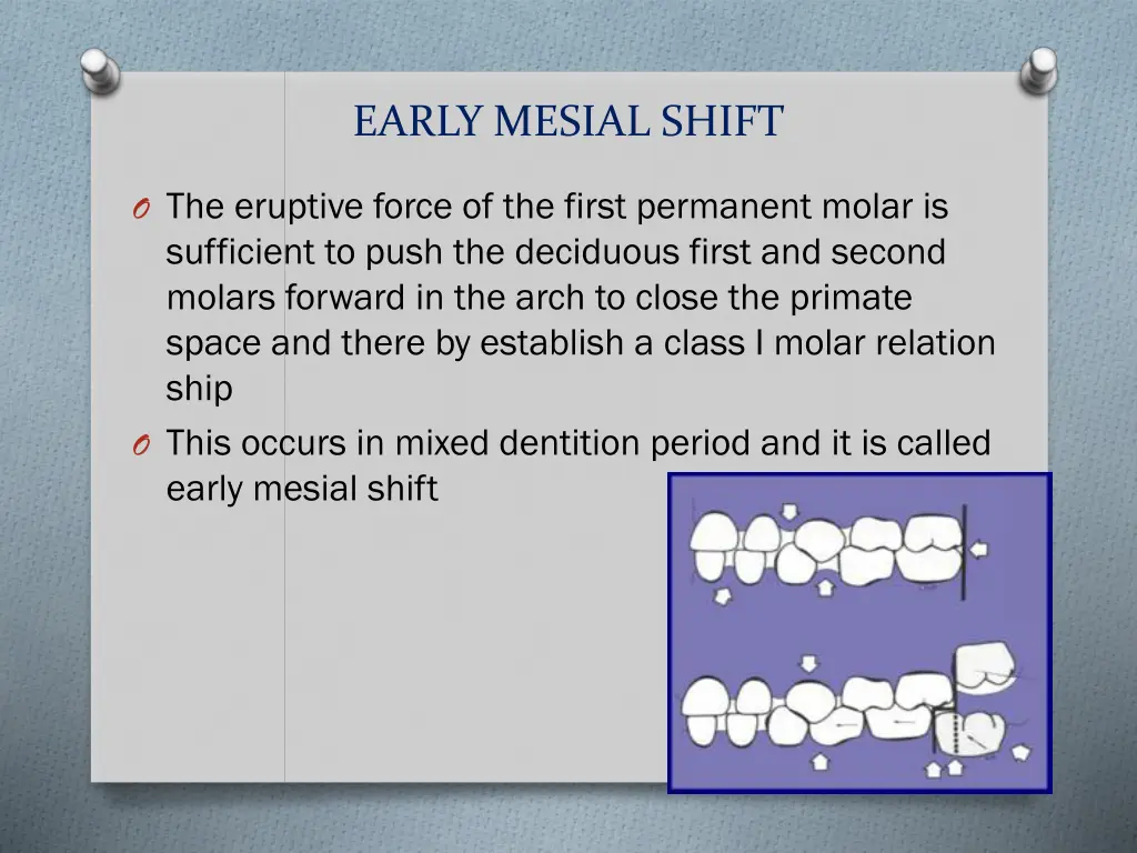 early mesial shift