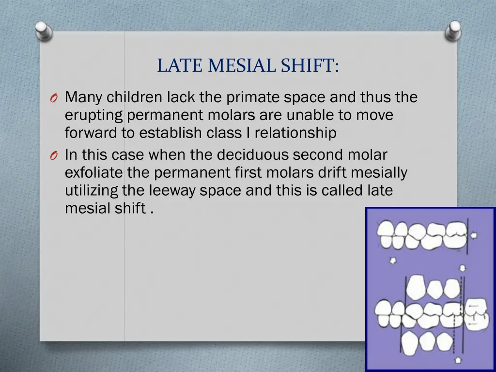 late mesial shift