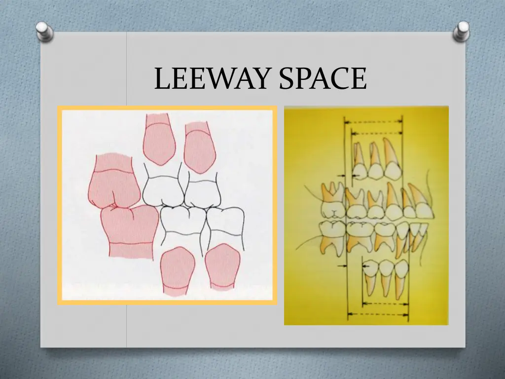 leeway space