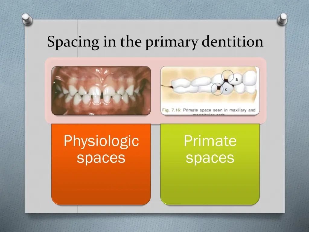 spacing in the primary dentition