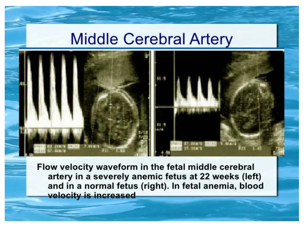 slide45