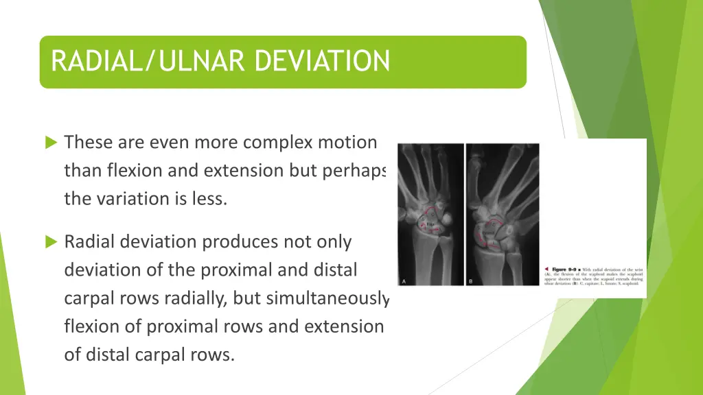 radial ulnar deviation