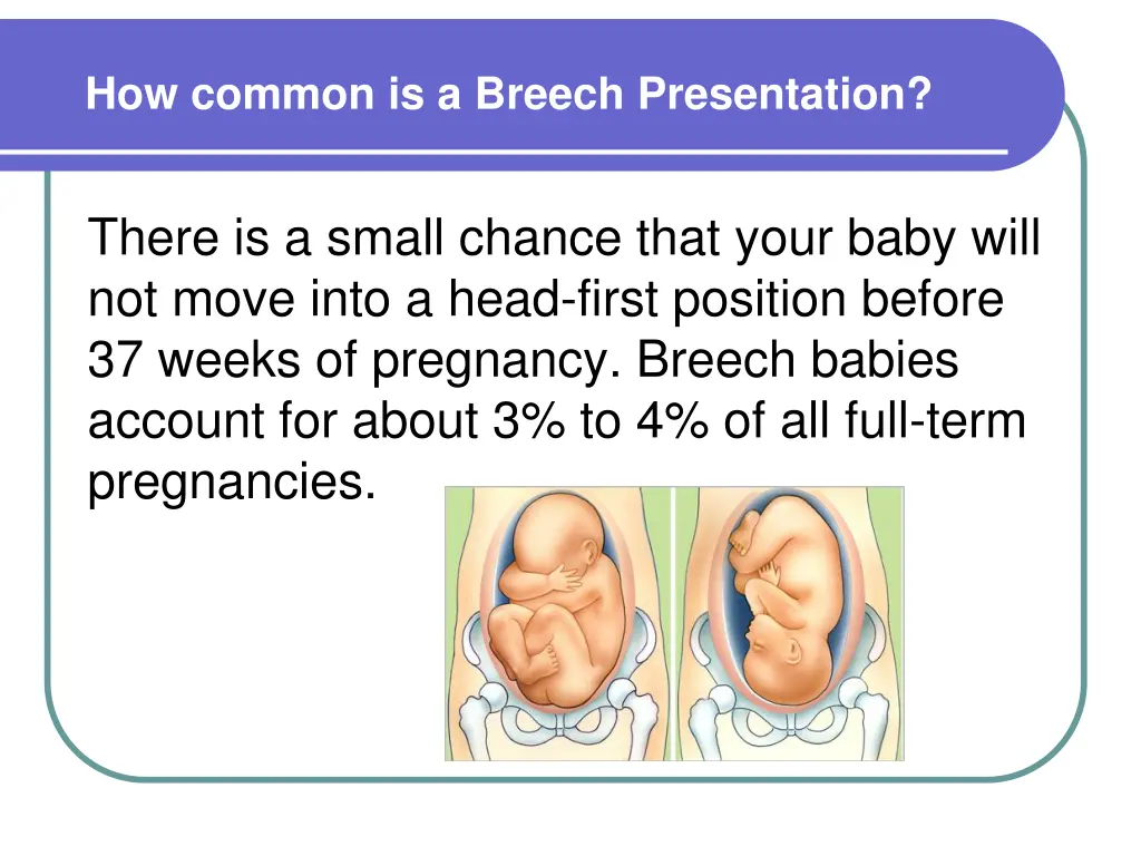 how common is a breech presentation