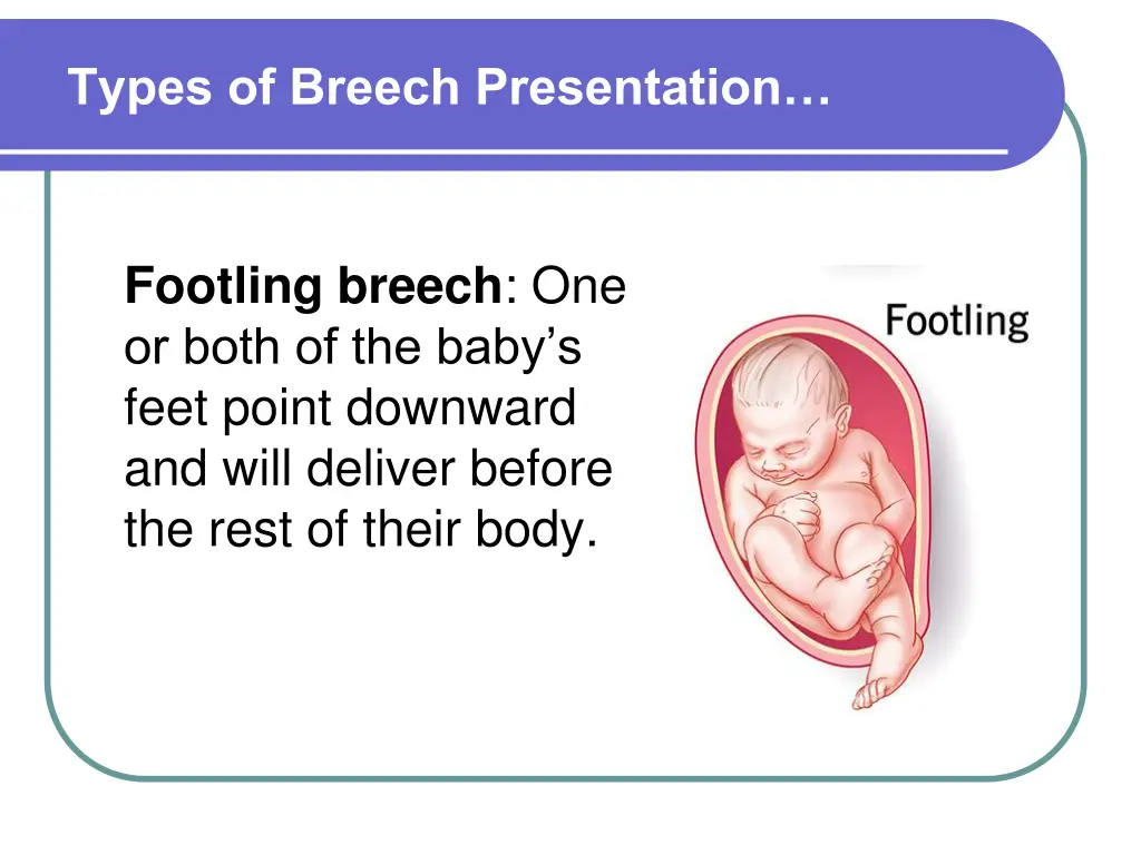 types of breech presentation 2