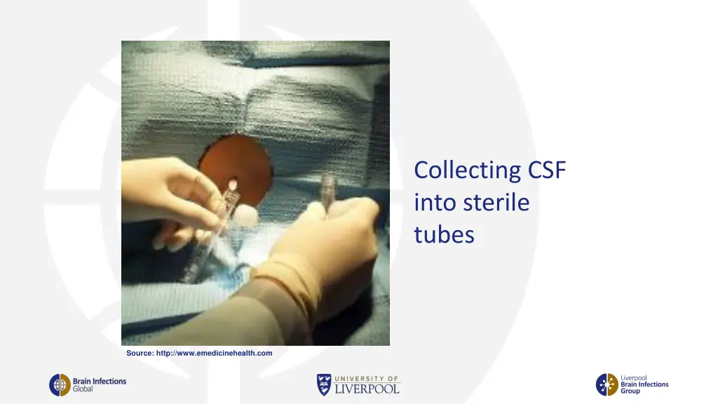 collecting csf into sterile tubes