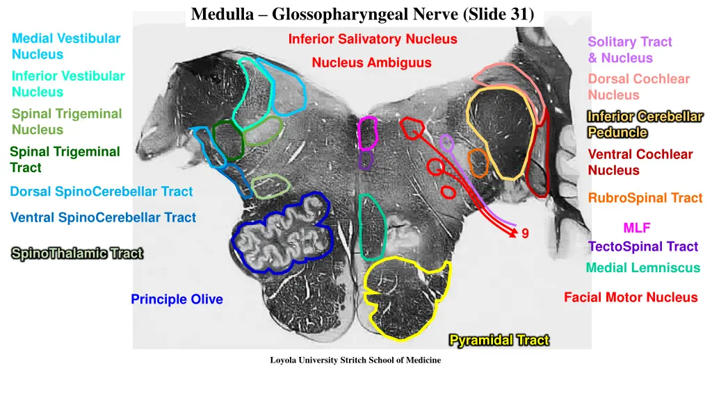 medulla glossopharyngeal nerve slide 31