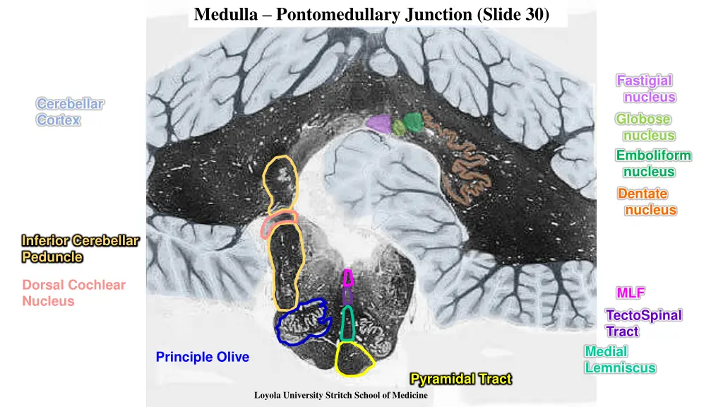 medulla pontomedullary junction slide 30