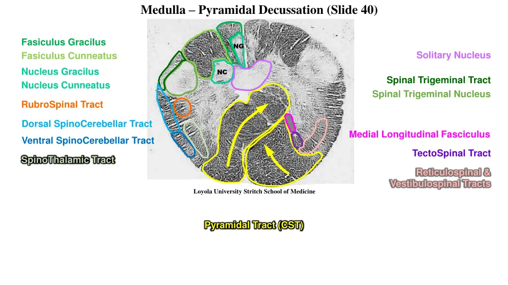 medulla pyramidal decussation slide 40