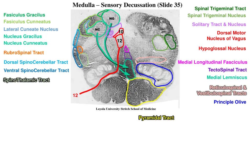 medulla sensory decussation slide 35