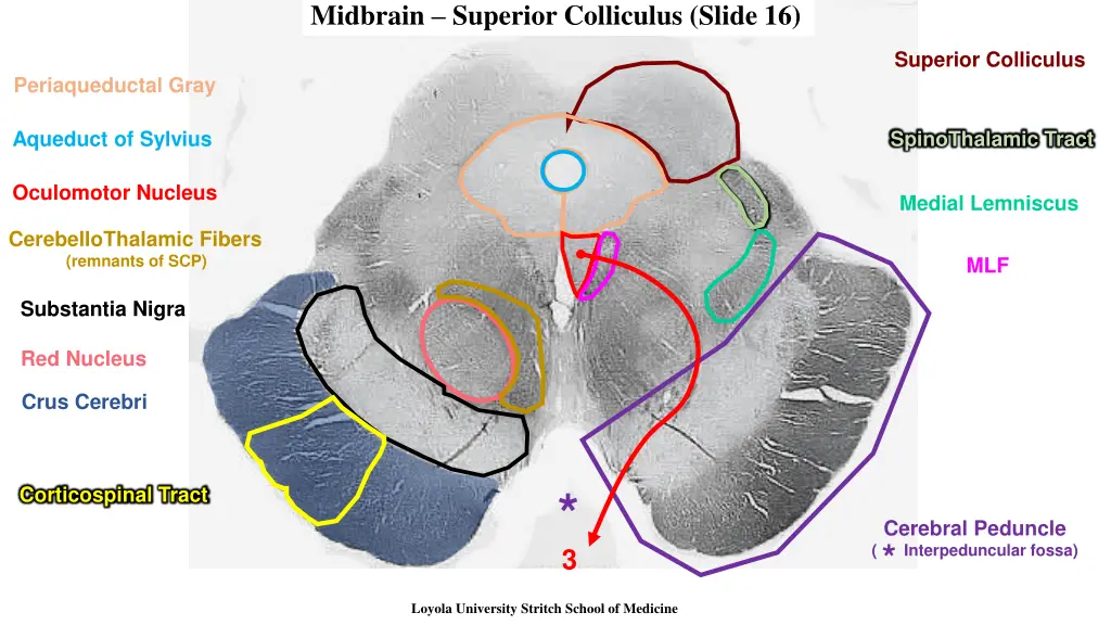 midbrain superior colliculus slide 16