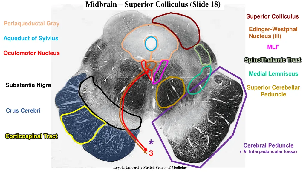 midbrain superior colliculus slide 18