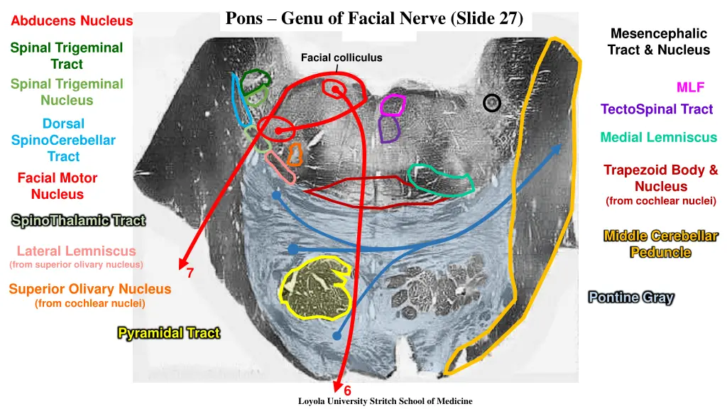 pons genu of facial nerve slide 27