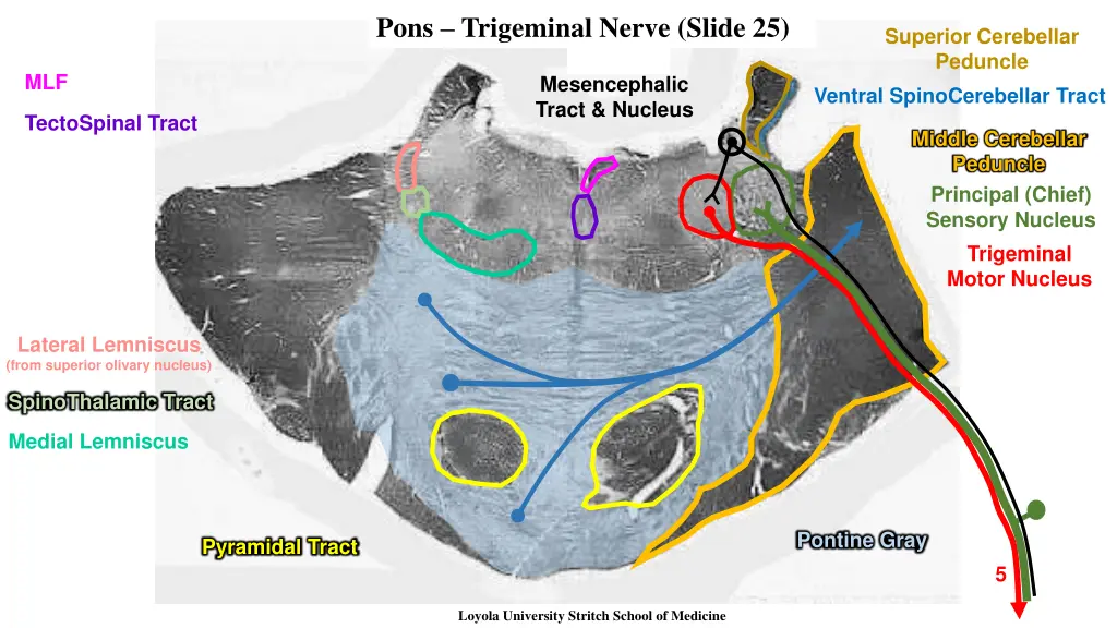 pons trigeminal nerve slide 25