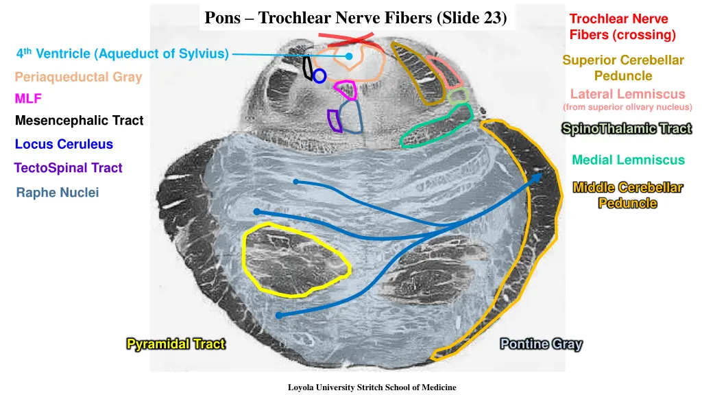 pons trochlear nerve fibers slide 23