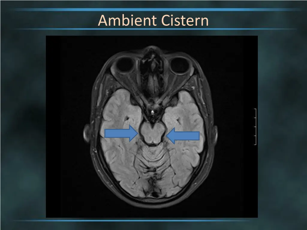 ambient cistern 1